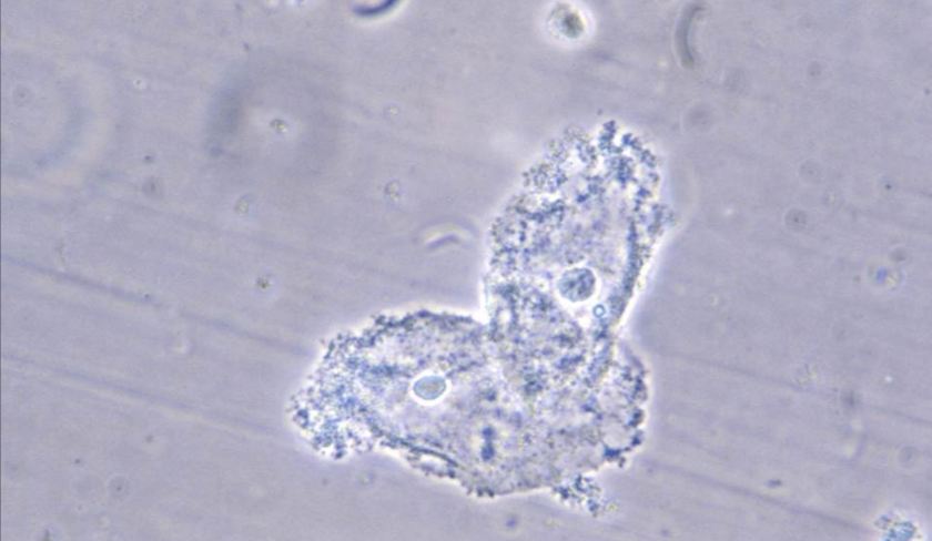 ГАРДНЕРРЕЛА / Gardnerella vaginalis / | Control.mn
